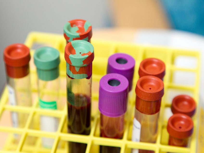 Stop non-urgent blood tests, NHS England warns GPs after nationwide shortage