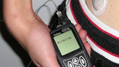 Nice | Pumps for diabetes that have integrated blood glucose sensors