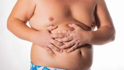 Nice | Non-alcoholic fatty liver disease NAFLD