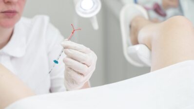 FSRH | Jaydess – a new levonorgestrel intrauterine system