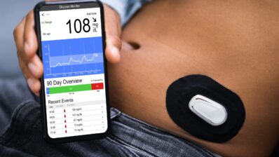 Dexcom G6 for continuous glucose monitoring