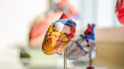 Icosapent ethyl and high triglyceride (TAG) levels (Nice, 2022)