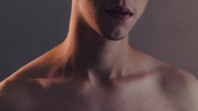 Video: Dr Tony Downs, actinic keratosis