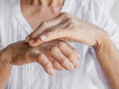 Podcast: Dr George Moncrieff on dermatology in GP