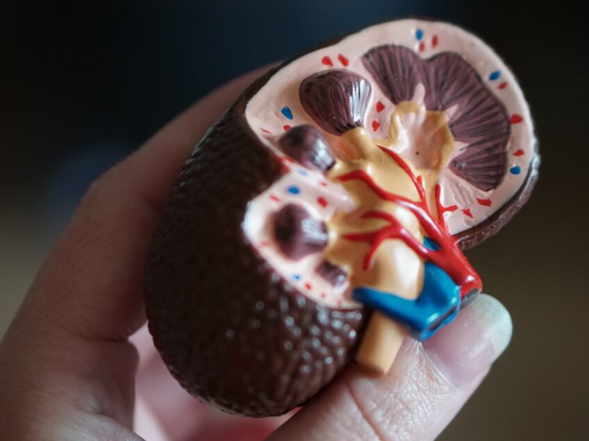 Finerenone for CKD in type 2 diabetes (Nice, March 2023)